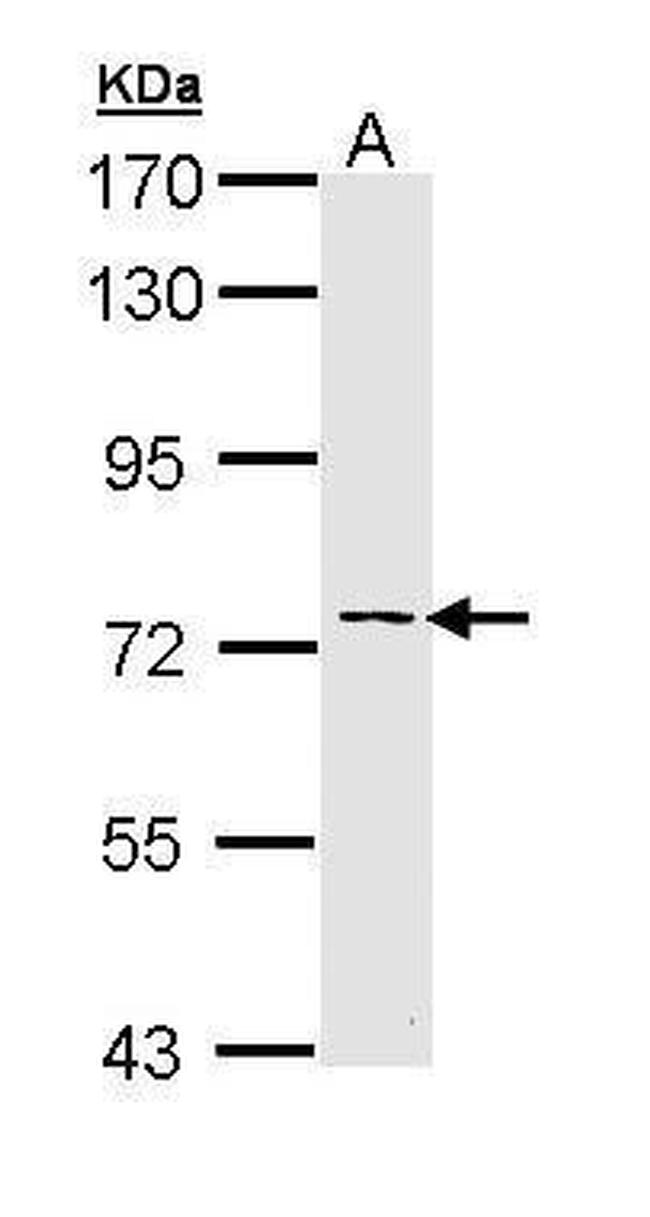 Adenylate Kinase 7 Antibody in Western Blot (WB)