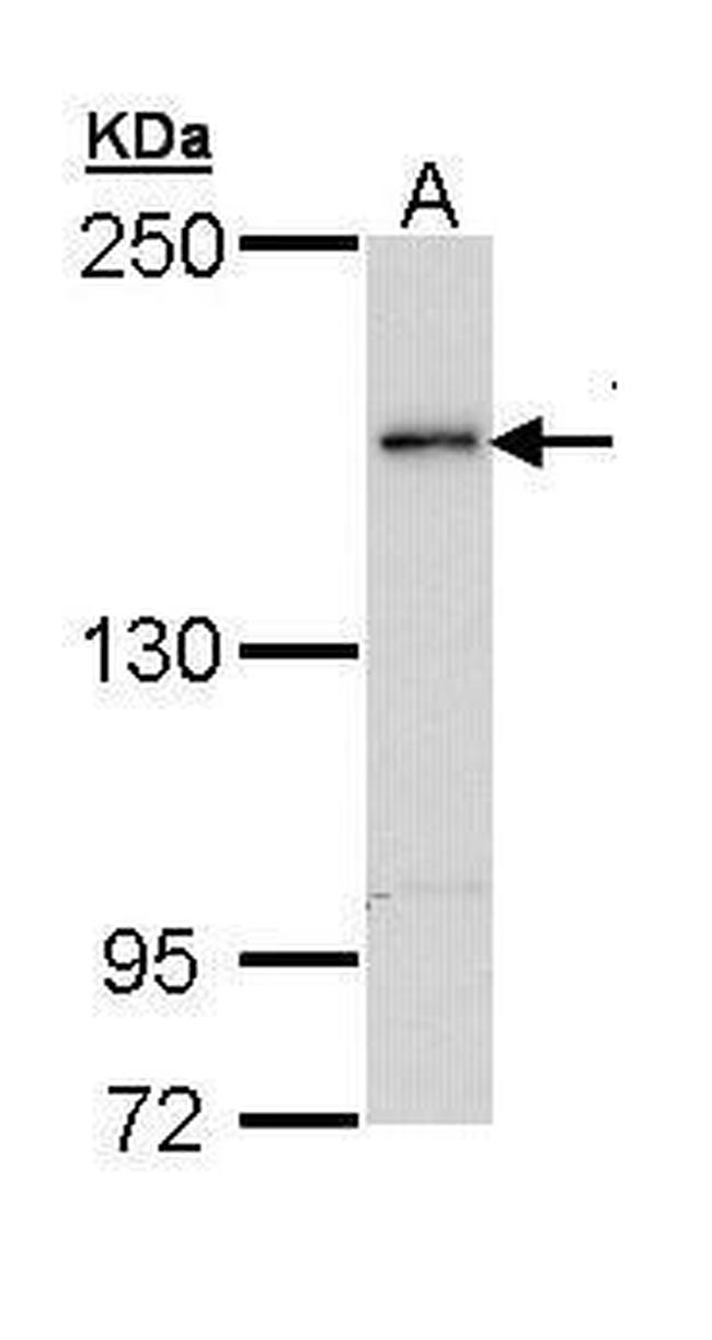 TEX14 Antibody in Western Blot (WB)