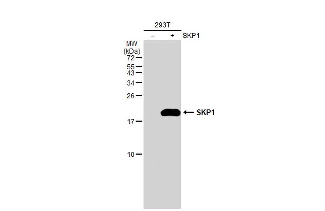SKP1 Antibody in Western Blot (WB)