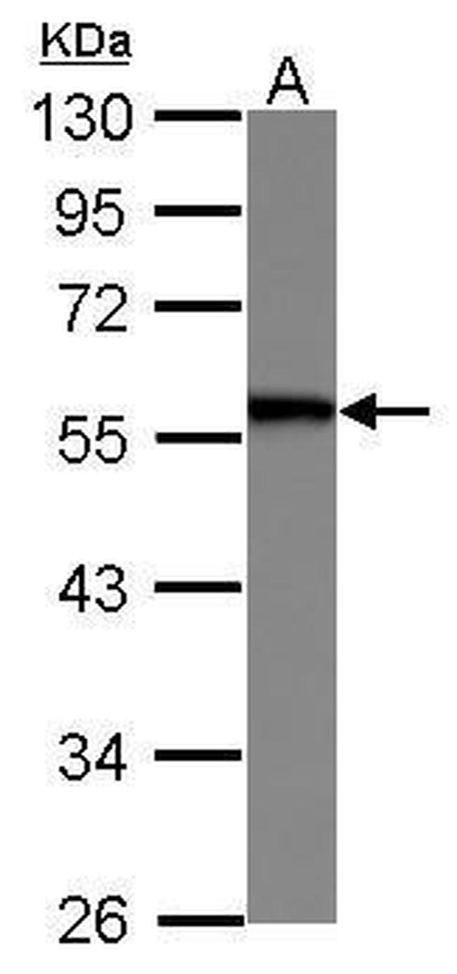 SERBP1 Antibody in Western Blot (WB)