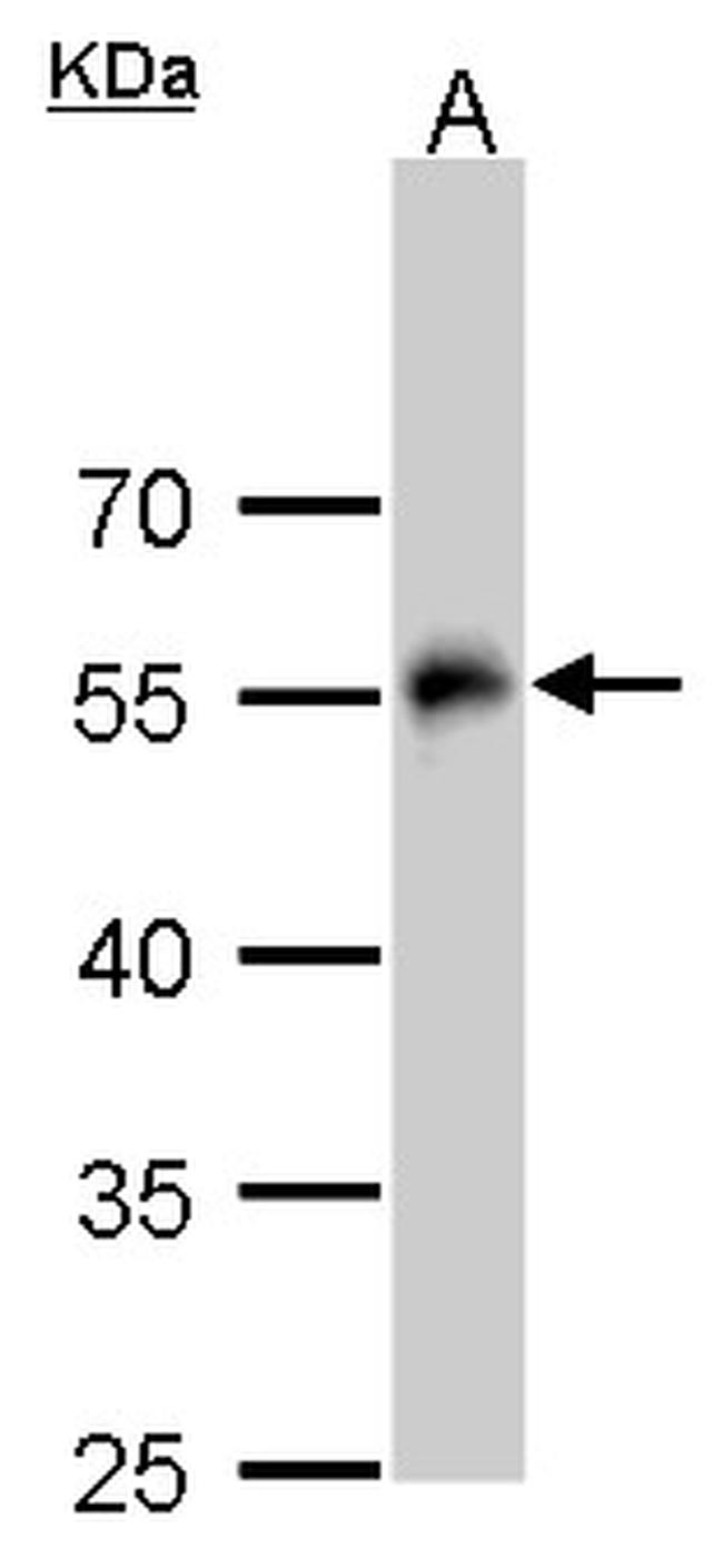 TUBA1A Antibody in Western Blot (WB)