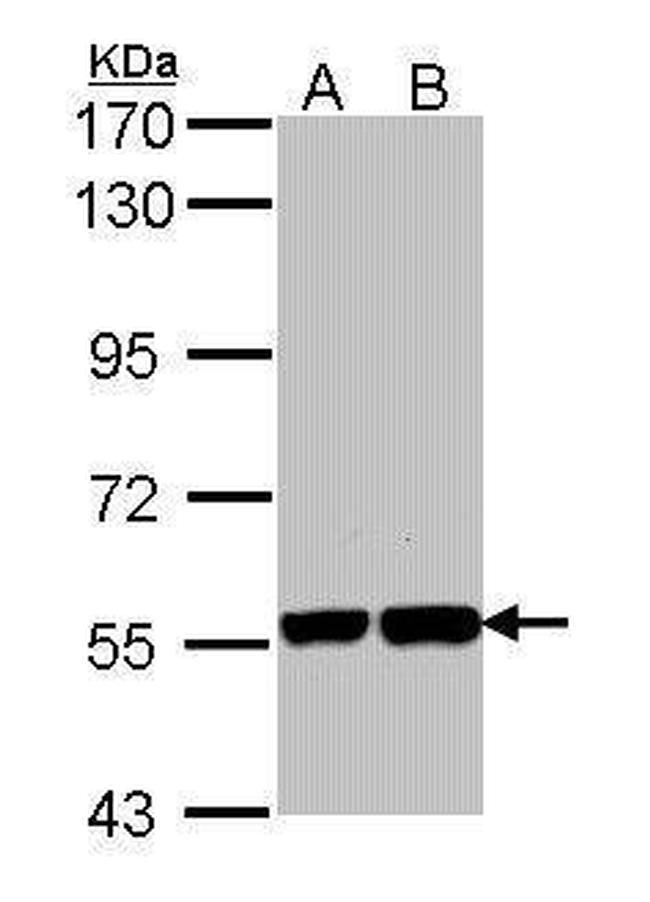 KPNA1 Antibody in Western Blot (WB)