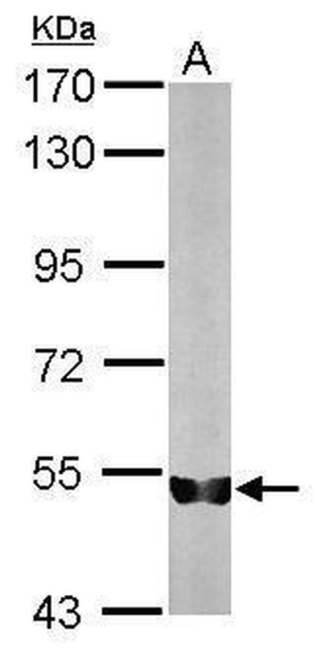 KPNA1 Antibody in Western Blot (WB)