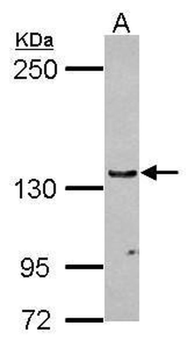 UPF1 Antibody in Western Blot (WB)