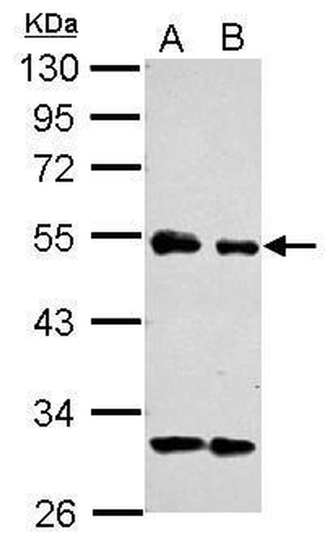 eIF3e Antibody in Western Blot (WB)