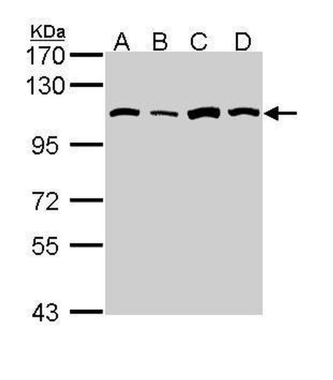 alanyl-tRNA Synthetase Antibody in Western Blot (WB)