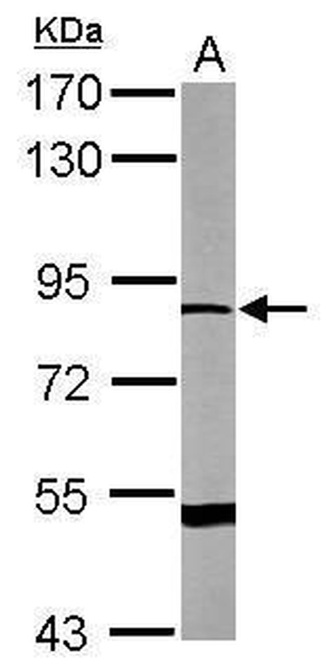 DRP2 Antibody in Western Blot (WB)