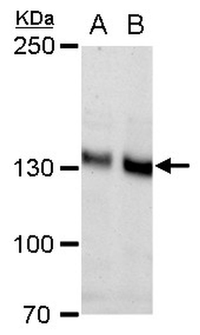 N-cadherin Antibody in Western Blot (WB)