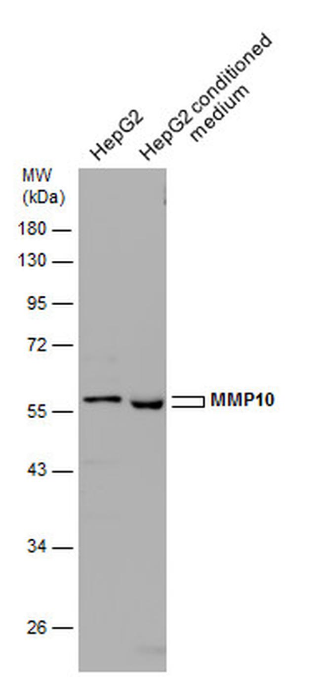 MMP10 Antibody in Western Blot (WB)