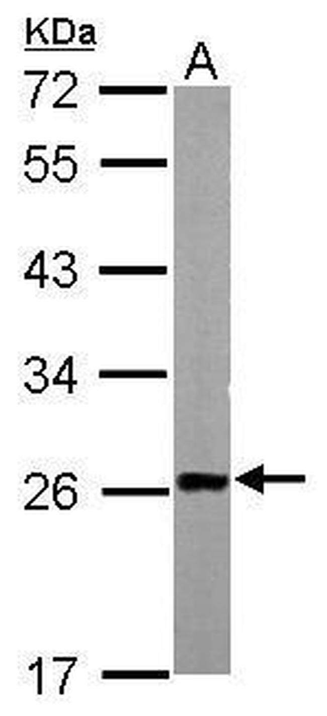 TAGLN Antibody in Western Blot (WB)