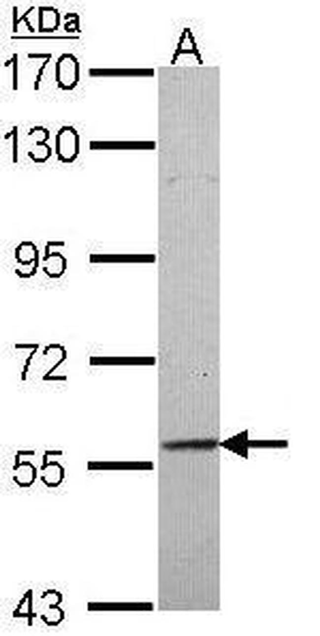 TRAF3IP2 Antibody in Western Blot (WB)