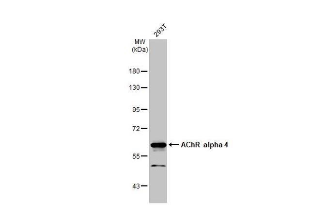 CHRNA4 Antibody in Western Blot (WB)