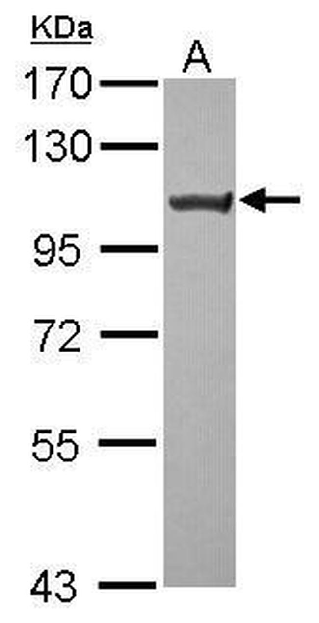 TRPC6 Antibody in Western Blot (WB)