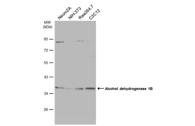 Alcohol Dehydrogenase 1B Antibody in Western Blot (WB)