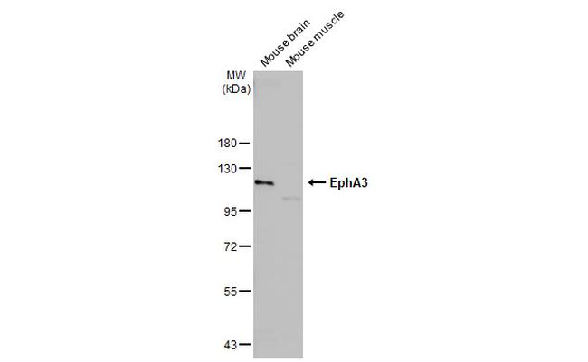 EphA3 Antibody in Western Blot (WB)