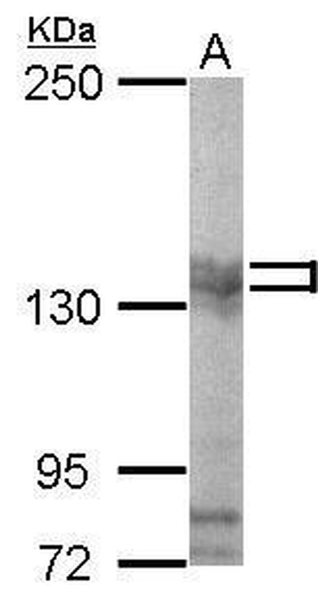 PUM2 Antibody in Western Blot (WB)