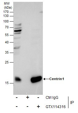 Centrin 1 Antibody in Immunoprecipitation (IP)