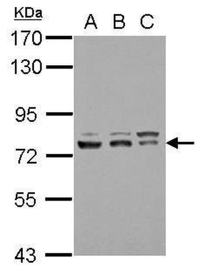 GTF2F1 Antibody in Western Blot (WB)
