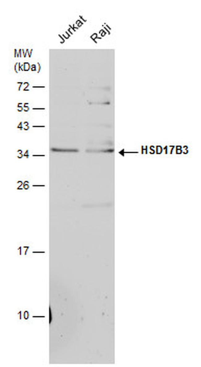 HSD17B3 Antibody in Western Blot (WB)