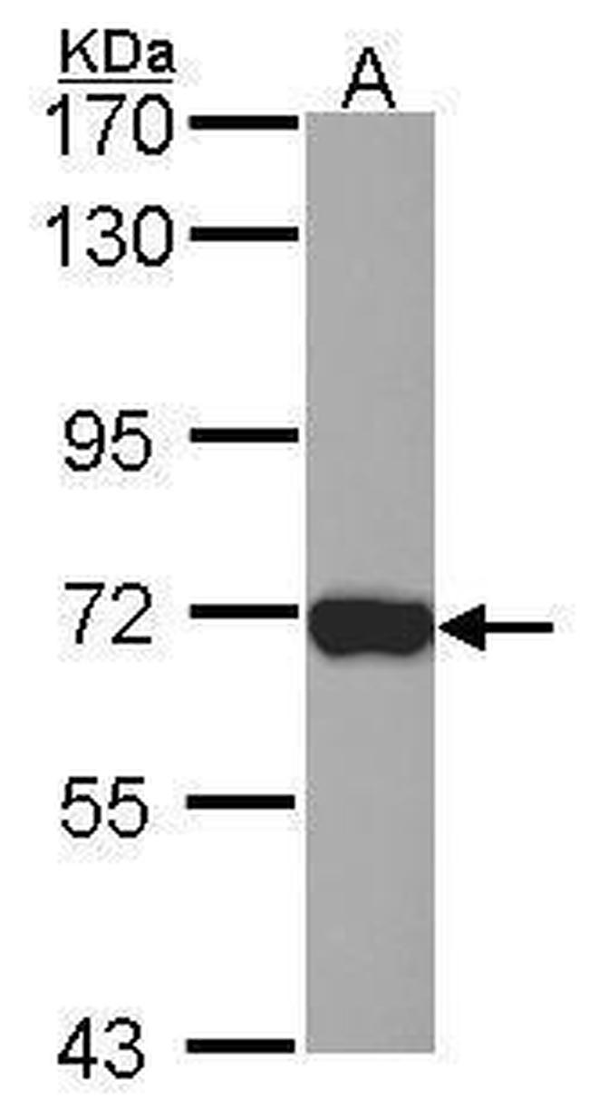 L-Plastin Antibody in Western Blot (WB)