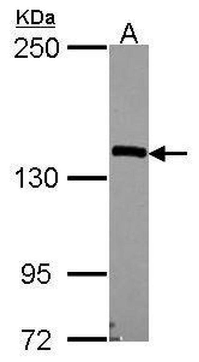 Nardilysin Antibody in Western Blot (WB)