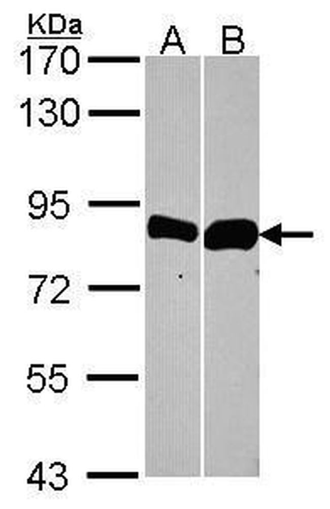 Thimet Oligopeptidase Antibody in Western Blot (WB)