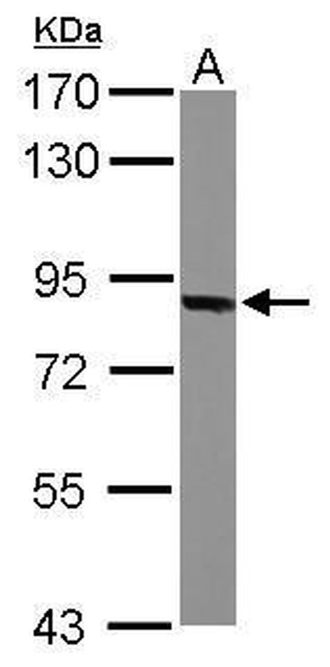 Thimet Oligopeptidase Antibody in Western Blot (WB)