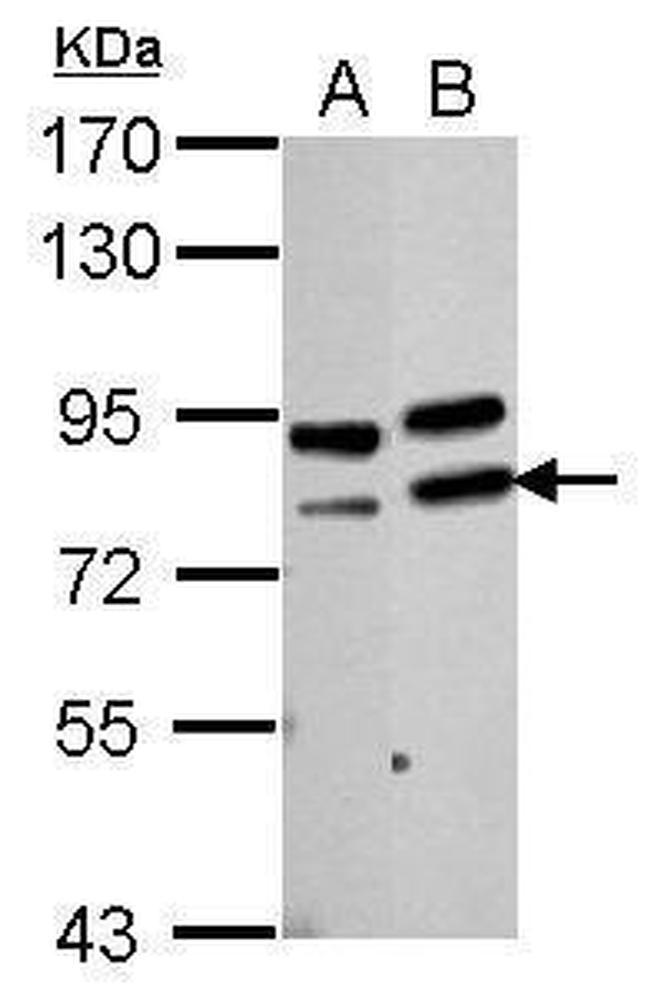 PARN Antibody in Western Blot (WB)