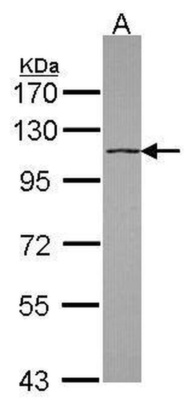 DHX16 Antibody in Western Blot (WB)