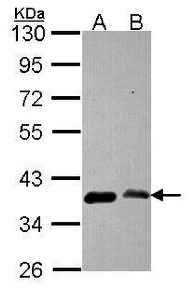 EMAP II Antibody in Western Blot (WB)