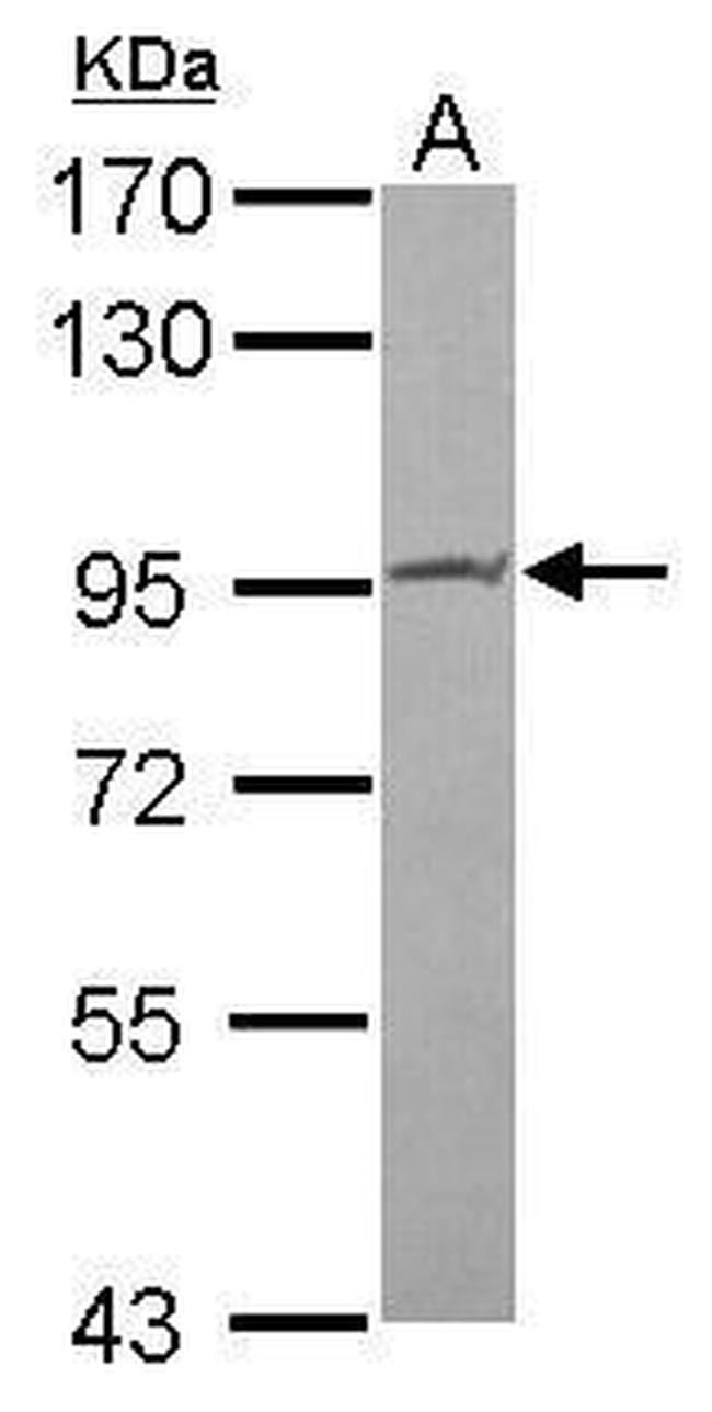 PIBF1 Antibody in Western Blot (WB)