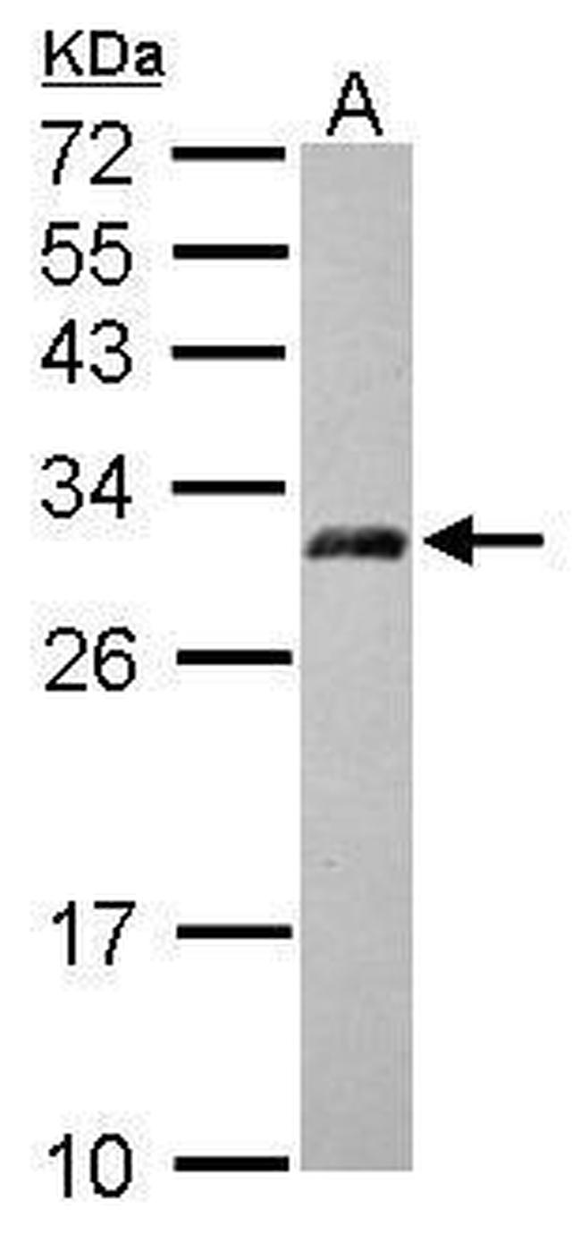 AP3M2 Antibody in Western Blot (WB)