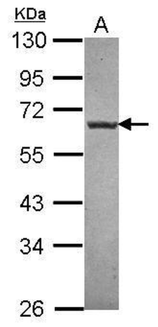 NTNG1 Antibody in Western Blot (WB)