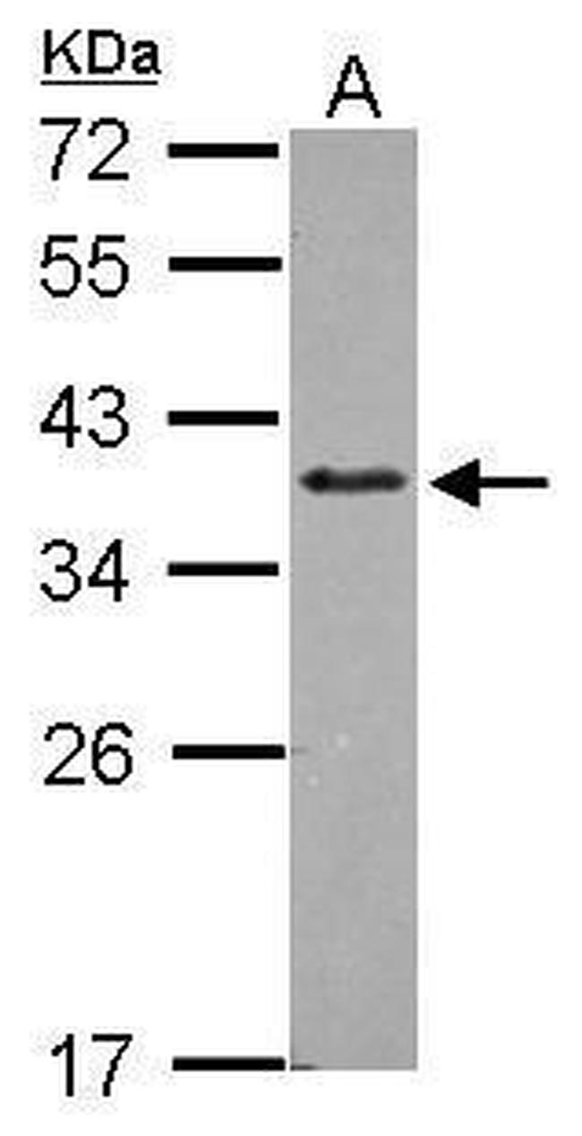 ZNF346 Antibody in Western Blot (WB)