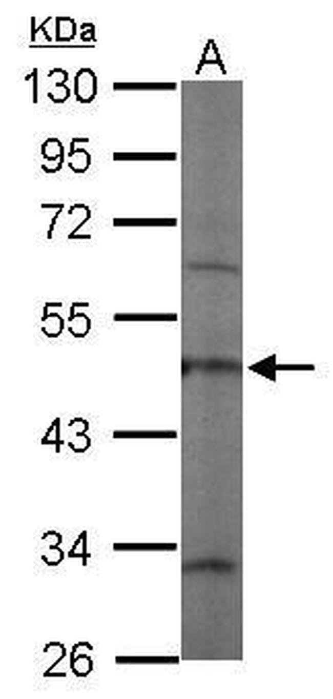 Coronin 3 Antibody in Western Blot (WB)