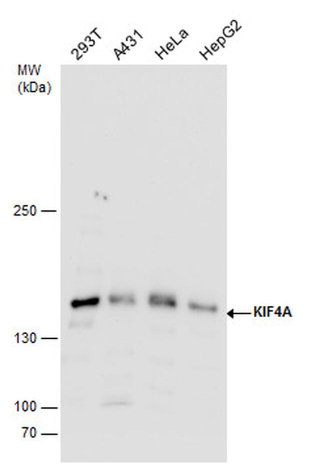 KIF4A Antibody in Western Blot (WB)