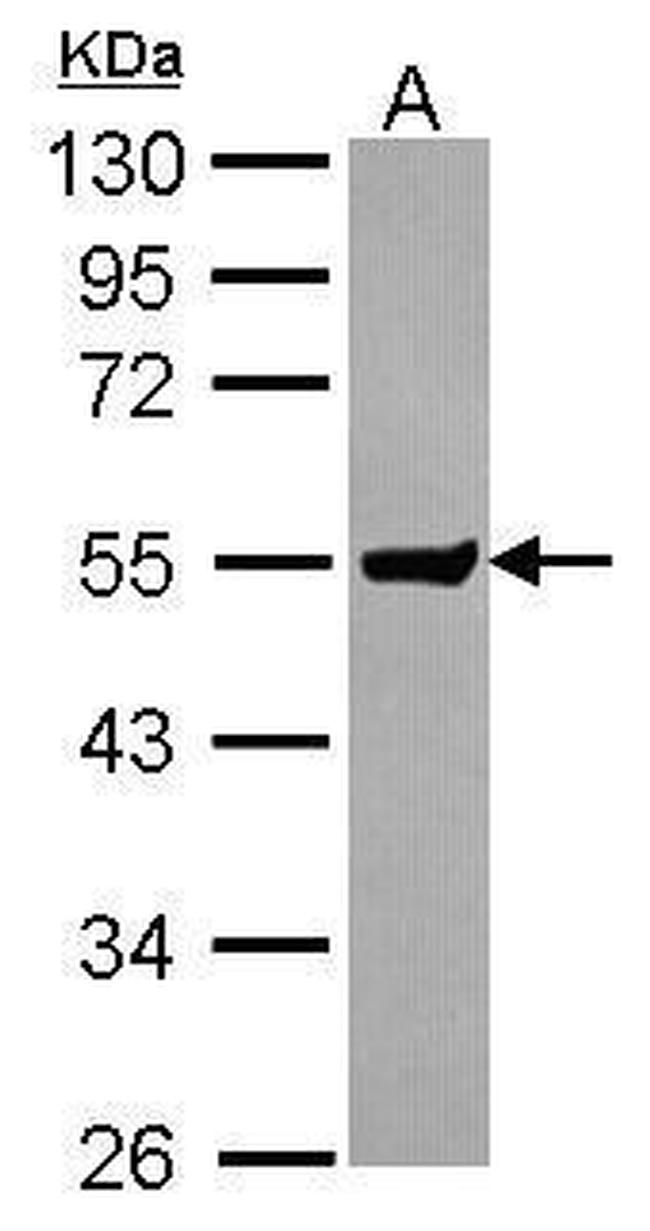 CLUL1 Antibody in Western Blot (WB)