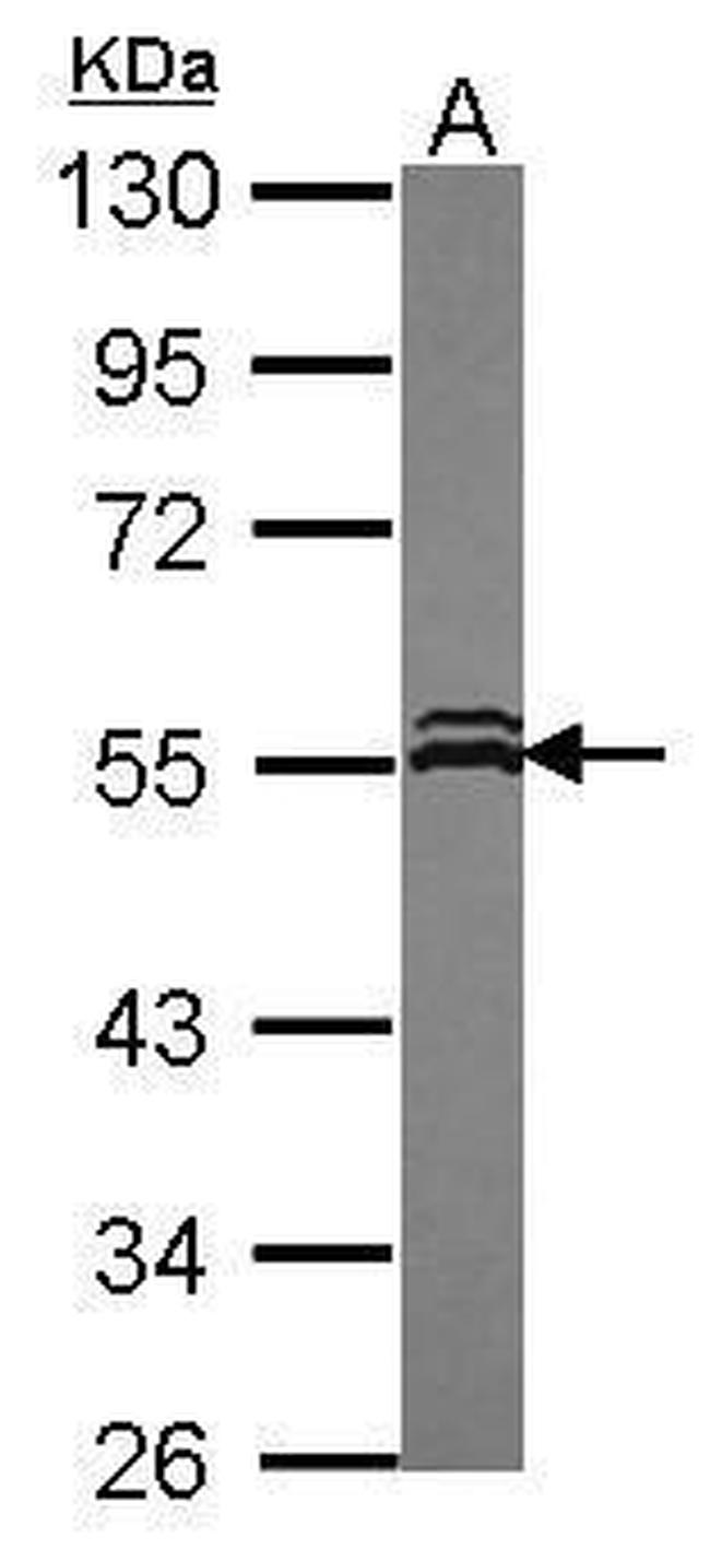VPS4A Antibody in Western Blot (WB)