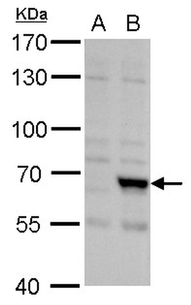 FBXL4 Antibody in Western Blot (WB)