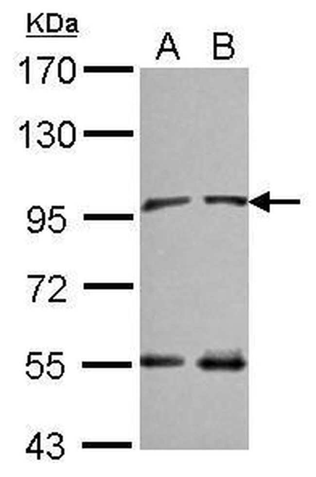 NAA15 Antibody in Western Blot (WB)
