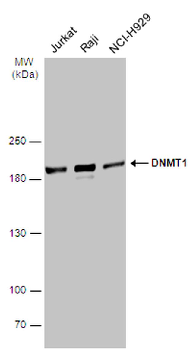 DNMT1 Antibody in Western Blot (WB)
