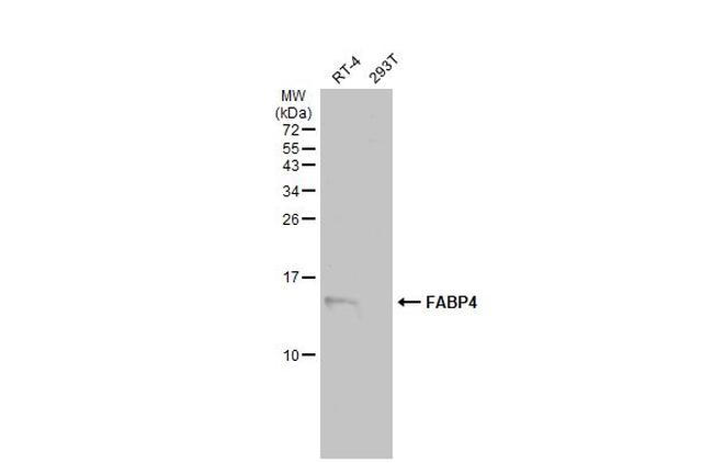 FABP4 Antibody in Western Blot (WB)