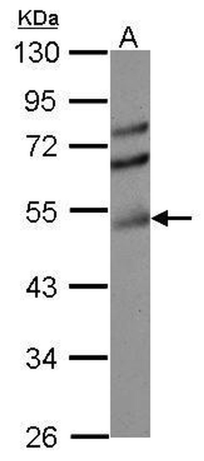 EAP2 Antibody in Western Blot (WB)