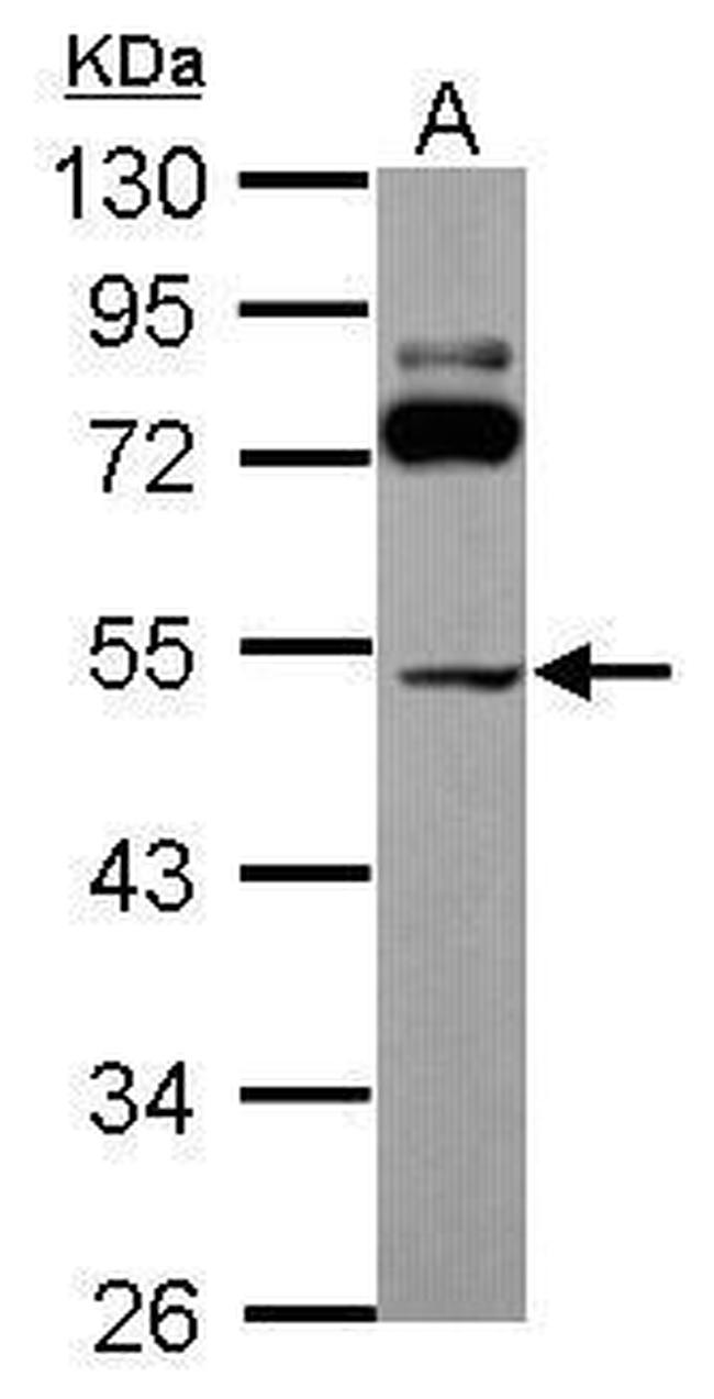SLC25A23 Antibody in Western Blot (WB)