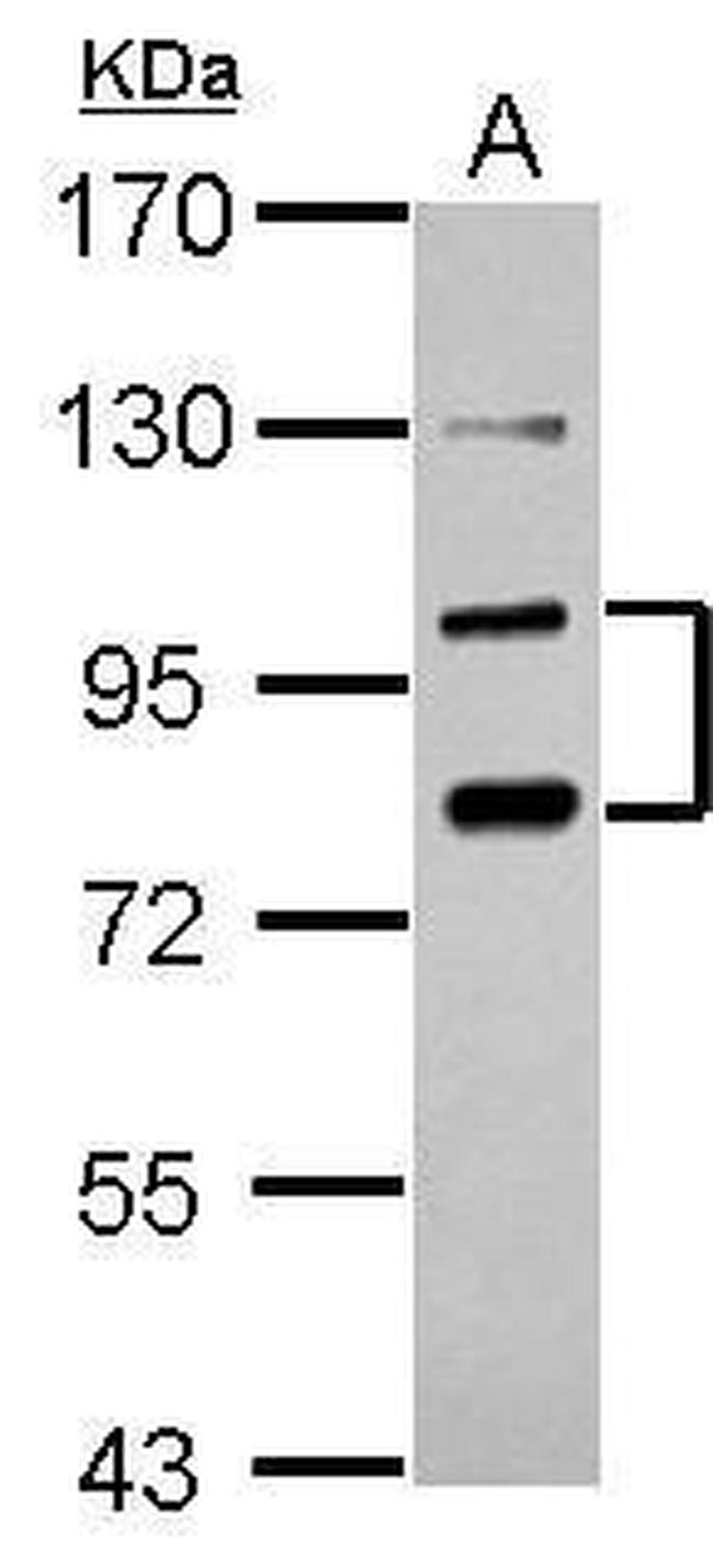 PCDHA6 Antibody in Western Blot (WB)