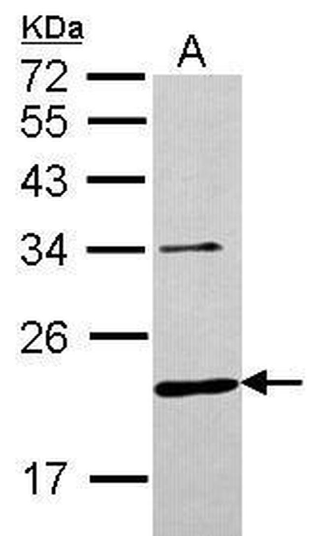 CHMP6 Antibody in Western Blot (WB)
