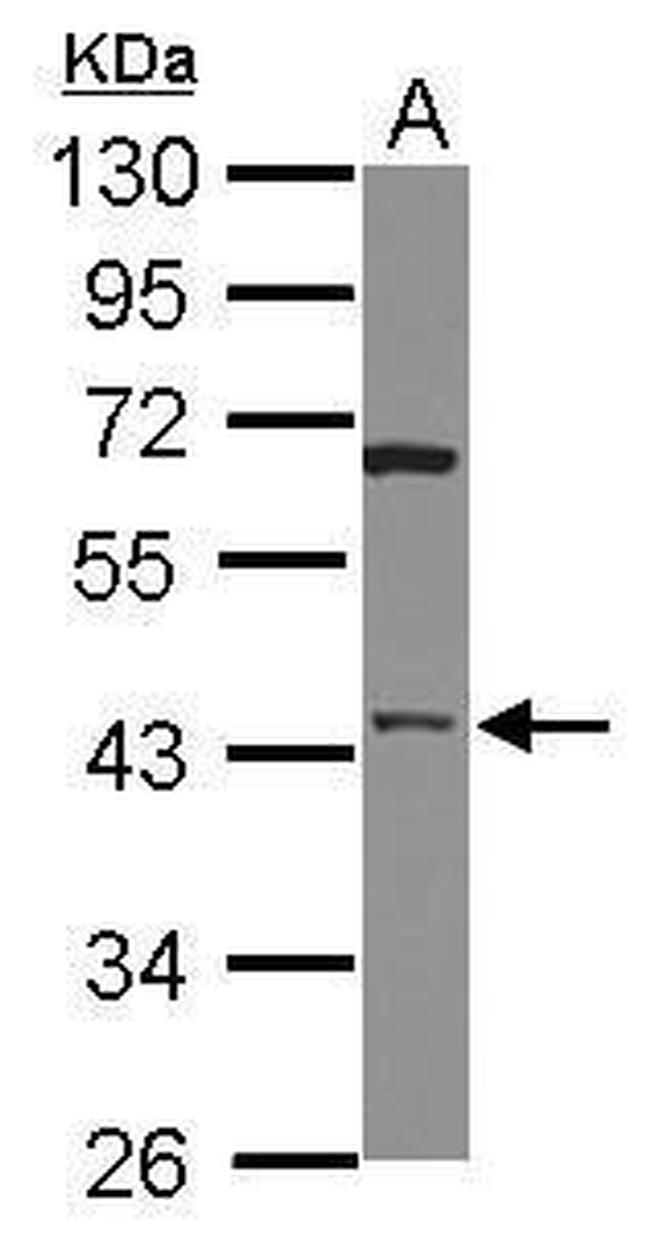 HTRA3 Antibody in Western Blot (WB)