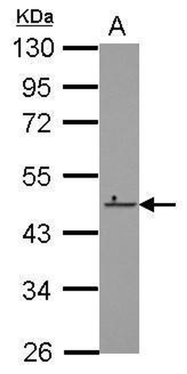 ZNF550 Antibody in Western Blot (WB)