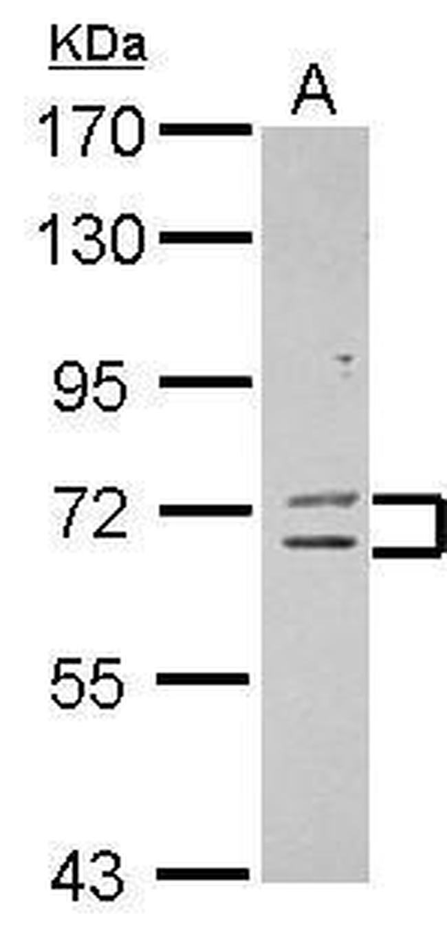 ZNF182 Antibody in Western Blot (WB)