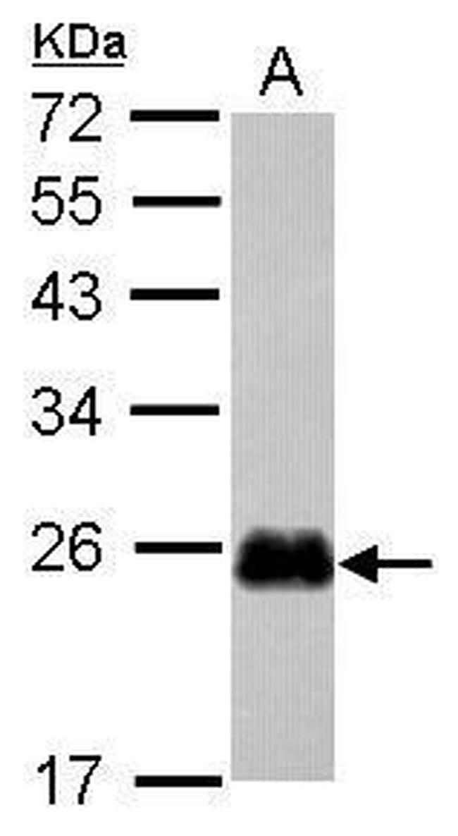 CRIP2 Antibody in Western Blot (WB)